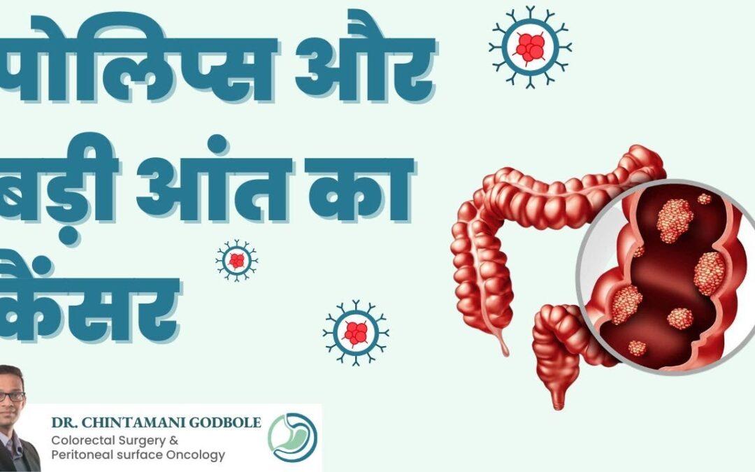 Polyps & Colorectal Cancer | Treatment of Colon cancer | Colorectal surgeon in Mumbai – Dr. Godbole