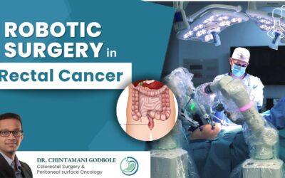 Robotic Surgery for Rectal Cancer I Advantages over Laparoscopic Surgery
