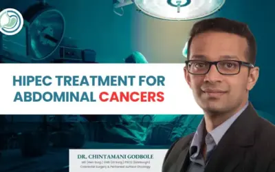 HIPEC: Advanced Treatment for Abdominal Cancers by Dr.Chintamani Godbole