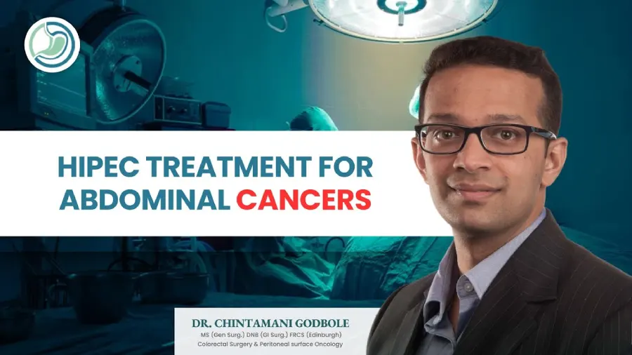 HIPEC: Advanced Treatment for Abdominal Cancers by Dr.Chintamani Godbole