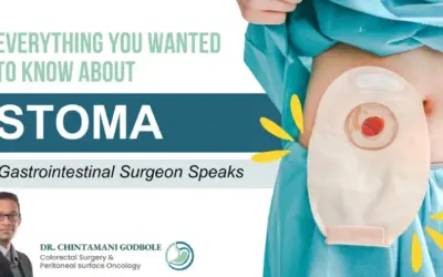 What is Stoma? How to Take Care of Stoma Bag