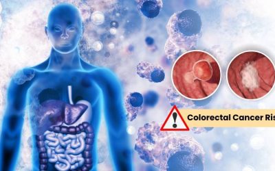 Understanding Colorectal Cancer: Risk Factors You Can and Can’t Control