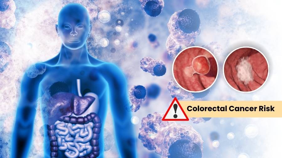 Understanding Colorectal Cancer: Risk Factors You Can and Can’t Control