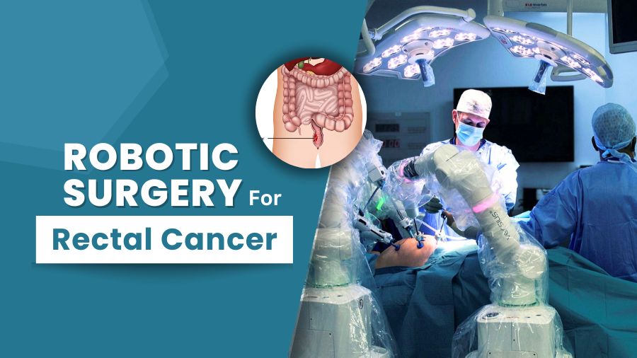 Why Consider Robotic Surgery for Rectal Cancer