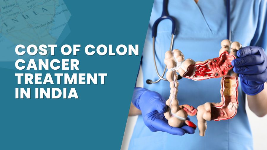 Cost of Colon Cancer Treatment in India